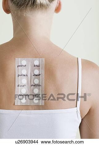Picture - Allergy test. Fotosearch