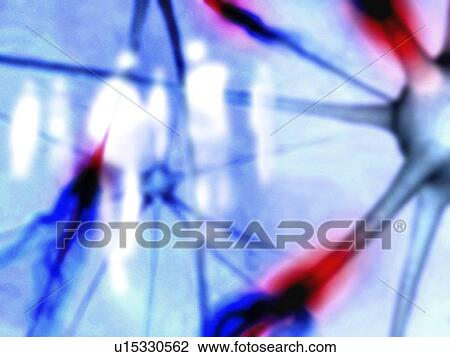 Alzheimer's disease View Large Photo Image Stock Image - Alzheimer's disease. Fotosearch