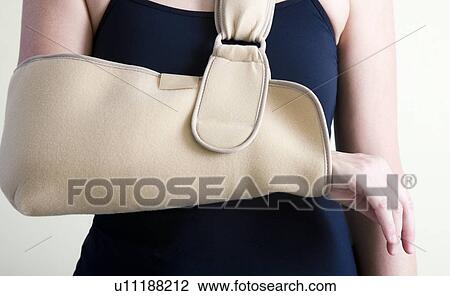 Arm in a sling View Large Photo Image Stock Image - Arm in a sling. Fotosearch
