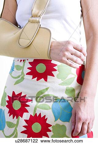 Stock Image - Arm in a sling. Fotosearch