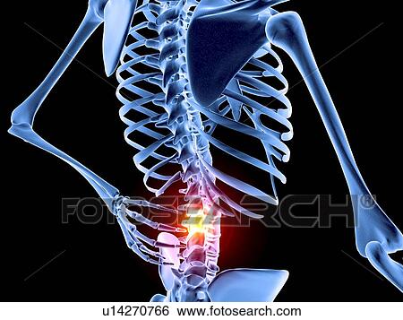 Back pain View Large Photo Image Stock Photograph - Back pain. Fotosearch
