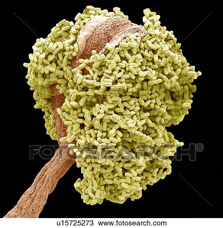 Bay tree anther, SEM View Large Photo Image Stock Image - Bay tree anther, SEM. Fotosearch