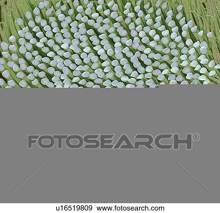 Stock Photo - Beetle foot, SEM. Fotosearch