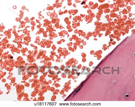 Stock Photo - Blood, light micrograph. Fotosearch