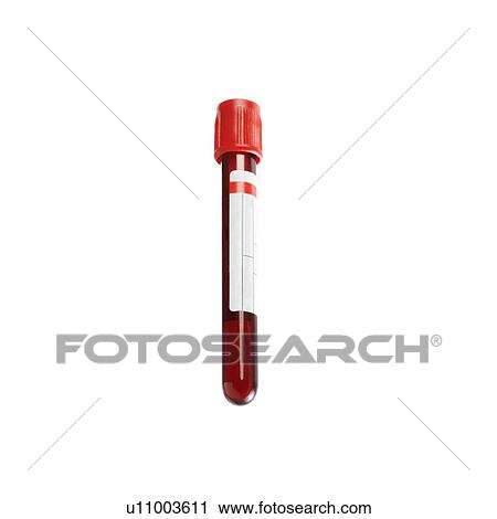 Stock Image - Blood sample. Fotosearch