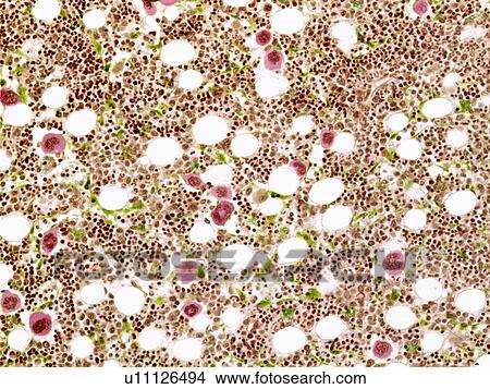 Picture - Bone marrow, light micrograph. Fotosearch