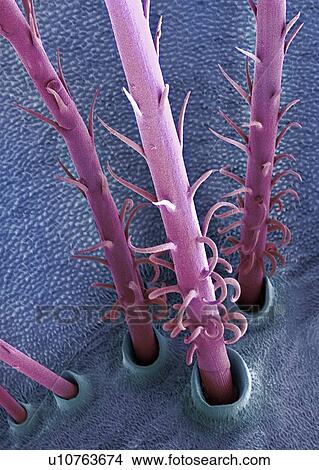 Picture - Caterpillar hairs, SEM. Fotosearch