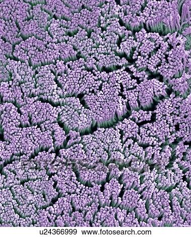 Stock Photo - Cervical lining, SEM. Fotosearch
