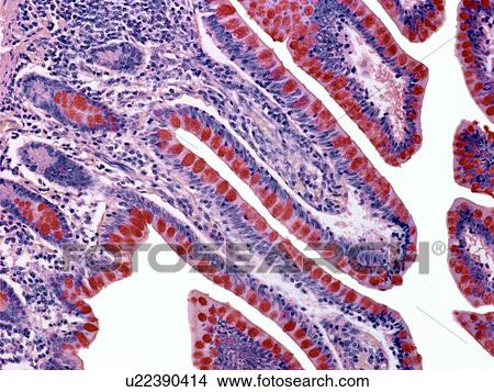 Colon lining, light micrograph View Large Photo Image Picture - Colon lining, light micrograph. Fotosearch