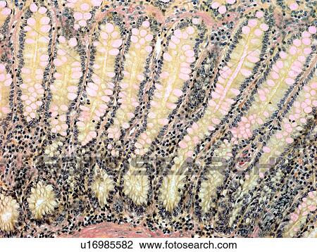 Colon lining, light micrograph View Large Photo Image Stock Image - Colon lining, light micrograph. Fotosearch