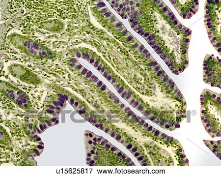 Colon lining, light micrograph View Large Photo Image Stock Photo - Colon lining, light micrograph. Fotosearch