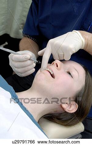 Stock Photograph - Dental braces. Fotosearch