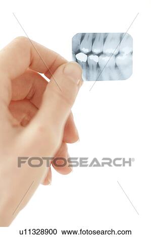 Stock Image - Dental X-ray. Fotosearch