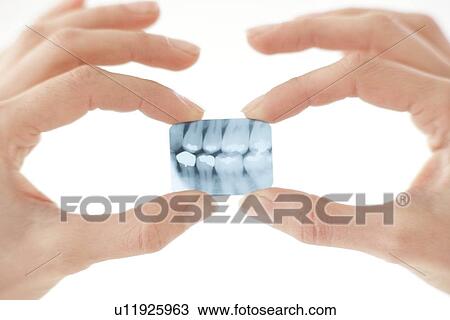 Stock Image - Dental X-ray. Fotosearch