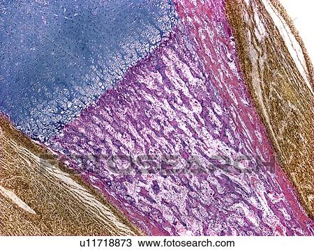 Stock Image - Developing bone, light micrograph. Fotosearch