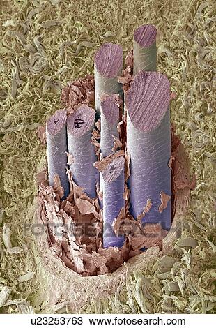 Stock Image - Dog hair, SEM. Fotosearch