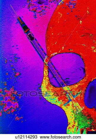 Stock Image - Drug abuse, conceptual artwork. Fotosearch