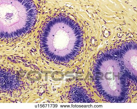 Stock Photo - Epididymis, light micrograph. Fotosearch