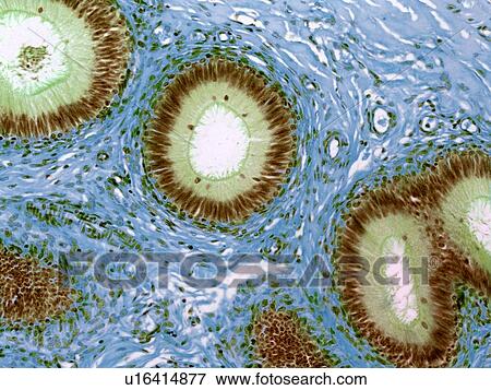 Epididymis, light micrograph View Large Photo Image Stock Photo - Epididymis, light micrograph. Fotosearch