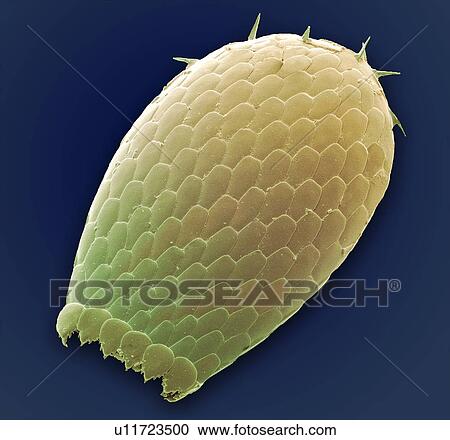 Stock Image - Euglypha amoeba shell, SEM. Fotosearch