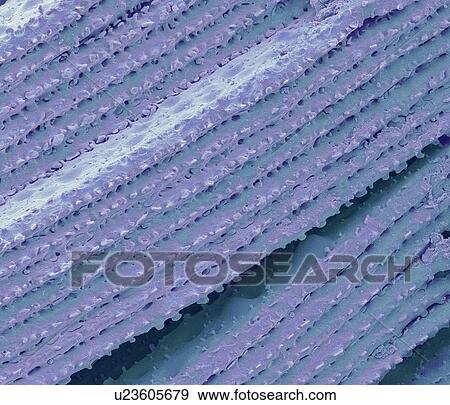 Stock Photo - Eye lens, SEM. Fotosearch