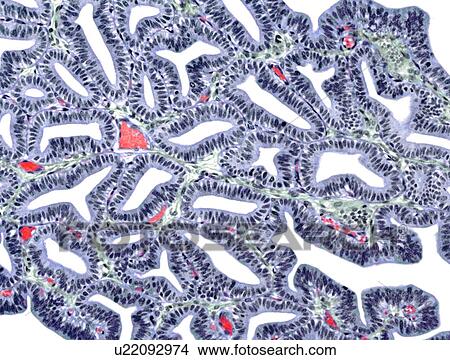 Fallopian tube, light micrograph View Large Photo Image Picture - Fallopian tube, light micrograph. Fotosearch