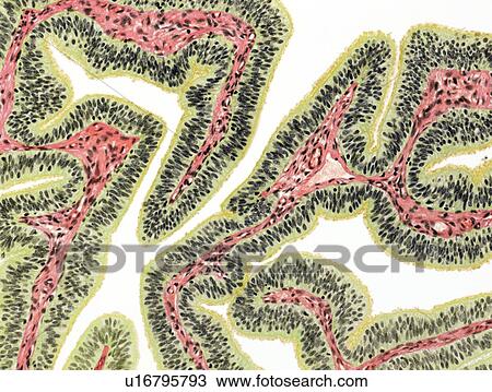 Fallopian tube, light micrograph View Large Photo Image Stock Image - Fallopian tube, light micrograph. Fotosearch