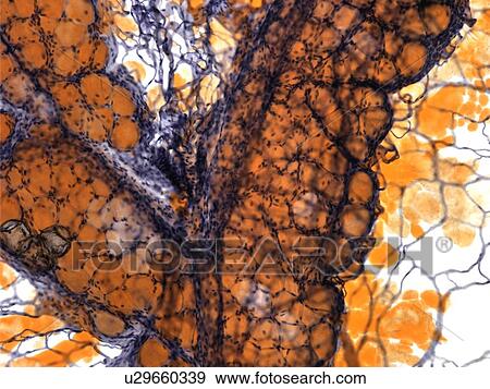 Stock Photo - Fat tissue, light micrograph. Fotosearch
