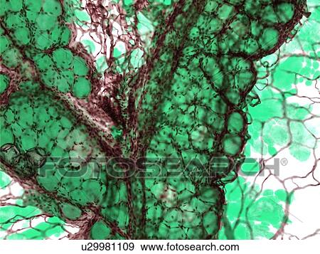 Fat tissue, light micrograph View Large Photo Image Stock Photo - Fat tissue, light micrograph. Fotosearch