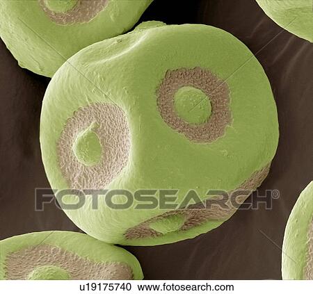 Flowering currant pollen, SEM View Large Photo Image Stock Image - Flowering currant pollen, SEM. Fotosearch
