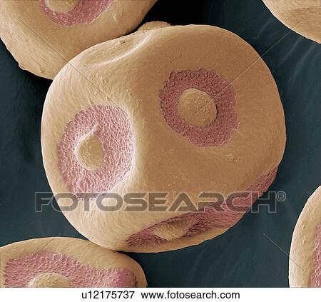 Flowering currant pollen, SEM View Large Photo Image Stock Photo - Flowering currant pollen, SEM. Fotosearch