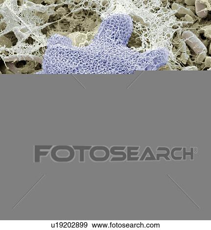 Stock Photo - Freshwater sponge, SEM. Fotosearch