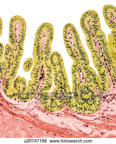 Stock Photograph - Gall bladder lining, light micrograph. Fotosearch