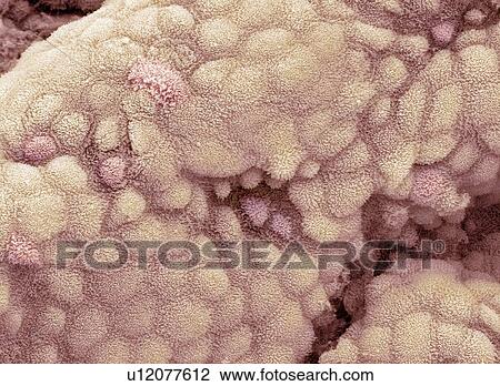 Gallbladder surface, SEM View Large Photo Image Stock Image - Gallbladder surface, SEM. Fotosearch