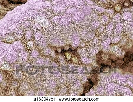 Stock Image - Gallbladder surface, SEM. Fotosearch