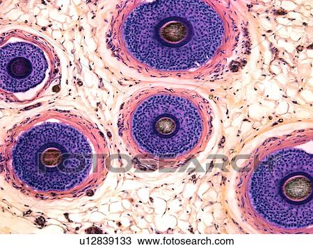 Stock Image - Hair follicles, light micrograph. Fotosearch