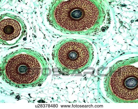 Hair follicles, light micrograph View Large Photo Image Stock Image - Hair follicles, light micrograph. Fotosearch