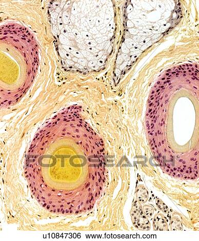Hair follicles, light micrograph View Large Photo Image Stock Photograph - Hair follicles, light micrograph. Fotosearch