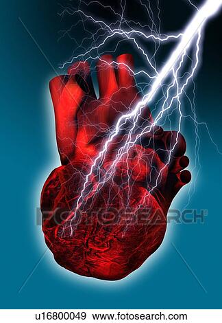 Heart attack, conceptual artwork View Large Photo Image Stock Photo - Heart attack, conceptual artwork. Fotosearch