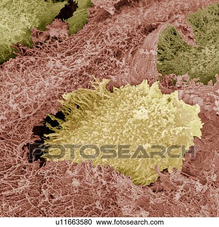 Stock Image - Hyaline cartilage, SEM. Fotosearch