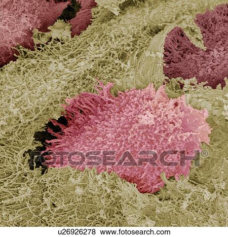 Stock Photo - Hyaline cartilage, SEM. Fotosearch