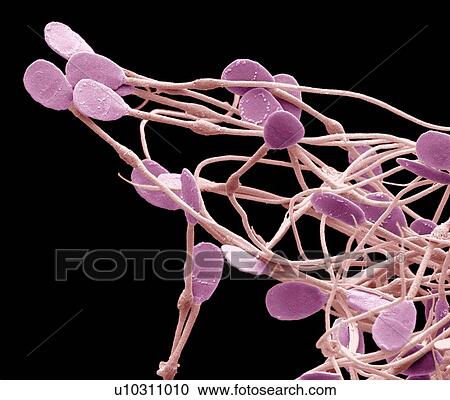 Stock Image - Immature dog sperm, SEM. Fotosearch