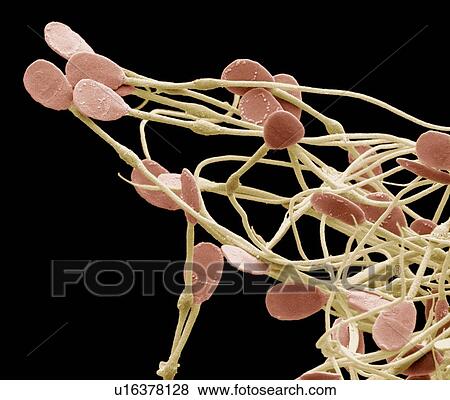 Stock Photo - Immature dog sperm, SEM. Fotosearch