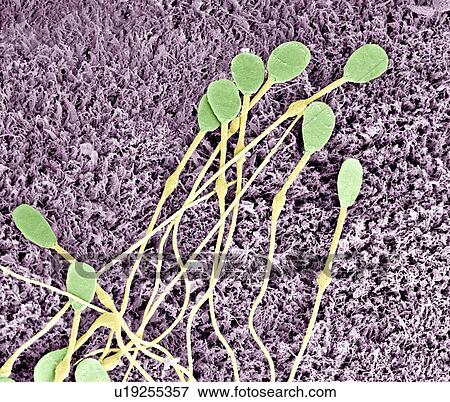 Stock Photo - Immature dog sperm, SEM. Fotosearch