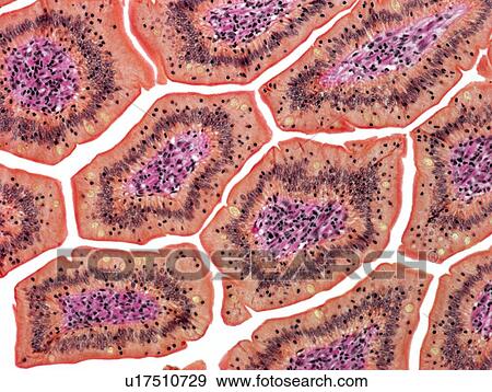 Intestinal villi, light micrograph View Large Photo Image Stock Photo - Intestinal villi, light micrograph. Fotosearch