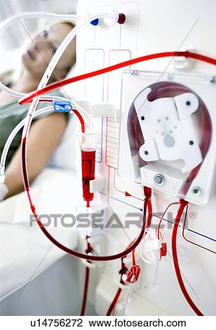 Stock Image - Kidney dialysis. Fotosearch