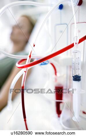 Kidney dialysis View Large Photo Image Stock Image - Kidney dialysis. Fotosearch