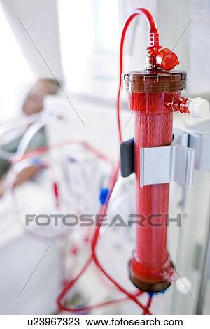 Kidney dialysis View Large Photo Image Stock Image - Kidney dialysis. Fotosearch