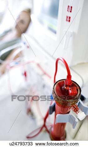Kidney dialysis View Large Photo Image Stock Image - Kidney dialysis. Fotosearch