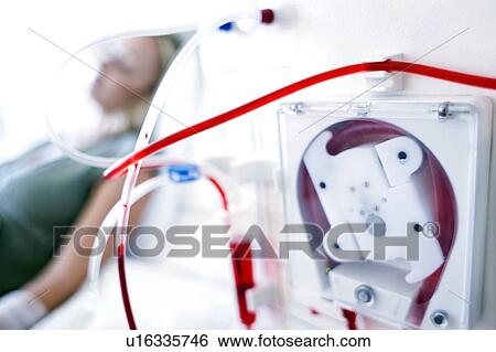 Stock Photograph - Kidney dialysis. Fotosearch